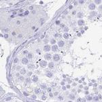 ZG16B Antibody in Immunohistochemistry (IHC)