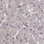 NAE1 Antibody in Immunohistochemistry (IHC)