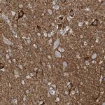 CR16 Antibody in Immunohistochemistry (IHC)