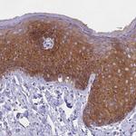 PPP1R13L Antibody in Immunohistochemistry (IHC)