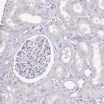 ZBP1 Antibody in Immunohistochemistry (IHC)