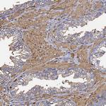 beta Actin Antibody in Immunohistochemistry (IHC)