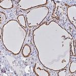 HnRNP Q Antibody in Immunohistochemistry (IHC)