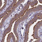 GAS8 Antibody in Immunohistochemistry (IHC)