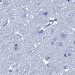 CYP51A1 Antibody in Immunohistochemistry (IHC)