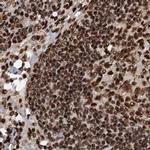 ZC3H18 Antibody in Immunohistochemistry (IHC)