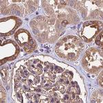 KARS Antibody in Immunohistochemistry (IHC)