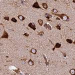 KARS Antibody in Immunohistochemistry (IHC)