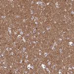 TMOD2 Antibody in Immunohistochemistry (IHC)