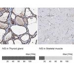 IVD Antibody in Immunohistochemistry (IHC)