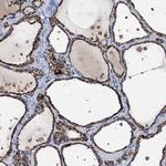 IVD Antibody in Immunohistochemistry (IHC)