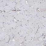 IVD Antibody in Immunohistochemistry (IHC)