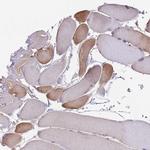 NUDT8 Antibody in Immunohistochemistry (IHC)