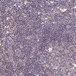 NUDT8 Antibody in Immunohistochemistry (IHC)