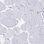 CD2BP2 Antibody in Immunohistochemistry (IHC)