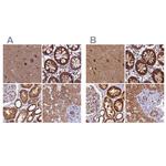 NDUFA8 Antibody in Immunohistochemistry (IHC)