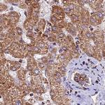 NDUFA8 Antibody in Immunohistochemistry (IHC)