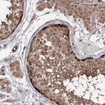 DEXI Antibody in Immunohistochemistry (IHC)