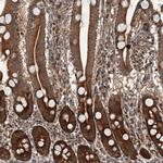 DEXI Antibody in Immunohistochemistry (IHC)