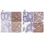 Sarcalumenin Antibody in Immunohistochemistry (IHC)