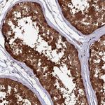 LCMT1 Antibody in Immunohistochemistry (IHC)