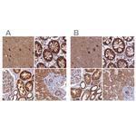 NDUFA8 Antibody in Immunohistochemistry (IHC)