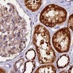 NDUFA8 Antibody in Immunohistochemistry (IHC)