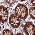 NDUFA8 Antibody in Immunohistochemistry (IHC)