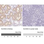 SGLT2 Antibody in Immunohistochemistry (IHC)