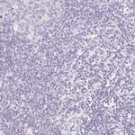 SGLT2 Antibody in Immunohistochemistry (IHC)