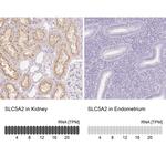 SGLT2 Antibody