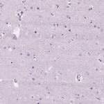 FDX1 Antibody in Immunohistochemistry (IHC)