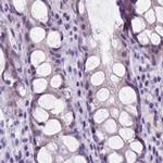 FDX1 Antibody in Immunohistochemistry (IHC)