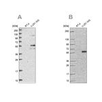 ACSBG1 Antibody in Western Blot (WB)