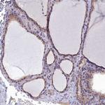 RABGAP1 Antibody in Immunohistochemistry (IHC)