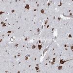 KCC4 Antibody in Immunohistochemistry (IHC)