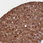 Flavin reductase Antibody in Immunohistochemistry (IHC)