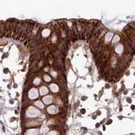 NULP1 Antibody in Immunohistochemistry (IHC)