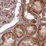 NULP1 Antibody in Immunohistochemistry (IHC)