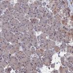 LYPLA3 Antibody in Immunohistochemistry (IHC)