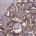 LYPLA3 Antibody in Immunohistochemistry (IHC)