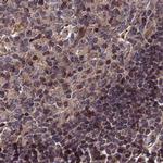 LYPLA3 Antibody in Immunohistochemistry (IHC)