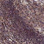 LYPLA3 Antibody in Immunohistochemistry (IHC)