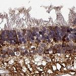 NPVF Antibody in Immunohistochemistry (IHC)