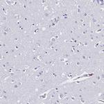 Galectin 10 Antibody in Immunohistochemistry (IHC)