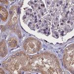 NUBP1 Antibody in Immunohistochemistry (IHC)