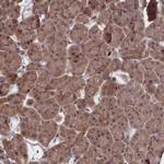 NUBP1 Antibody in Immunohistochemistry (IHC)