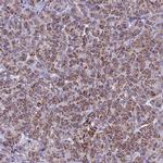 UQCRFS1 Antibody in Immunohistochemistry (IHC)