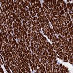 UQCRFS1 Antibody in Immunohistochemistry (IHC)