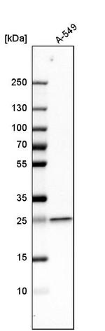 UQCRFS1 Antibody in Western Blot (WB)